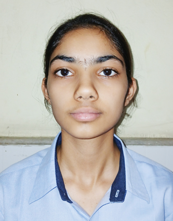 YASHIKA